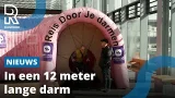 Rotterdammers hebben schijt aan darmonderzoek, artsen bezorgd