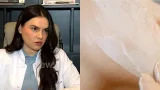 APLIKIMI I KREMIT TË DIELLIT NË DIMER/ Dermatologia Hajro: SPF përditë, në çdo stinë i domosdoshëm