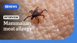 What is mammalian meat allergy and what role do ticks play? | ABC NEWS