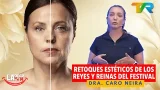 RETOQUES ESTÉTICOS DE LOS REYES Y REINAS DEL FESTIVAL CON LA DRA. CARO NEIRA | LA ONCE EN EL 14 RETOQUES ESTÉTICOS DE LOS REYES Y REINAS DEL FESTIVAL CON LA DRA. CARO NEIRA | LA ONCE EN EL 14