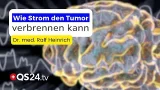 Galvano-Therapie: Krebs zerstört – ohne Chemo, ohne Strahlen: Mit Strom zum Heilungserfolg | QS24