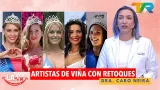 ARTISTAS DE VIÑA CON RETOQUES CON LA DRA. CARO NEIRA | LA ONCE EN EL 14 ARTISTAS DE VIÑA CON RETOQUES CON LA DRA. CARO NEIRA | LA ONCE EN EL 14