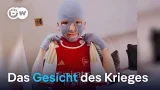 Ein 11jähriger verwundeter Ukrainer wirbt in den USA für sein Land | DW Nachrichten Ein 11jähriger verwundeter Ukrainer wirbt in den USA für sein Land | DW Nachrichten